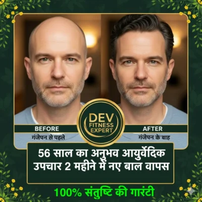 Ayurvedic remedy to get rid of baldness